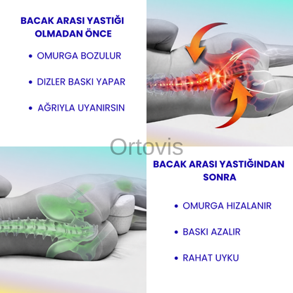 Ortovis Ortopedik Bel ve Siyatik Ağrı Yastığı